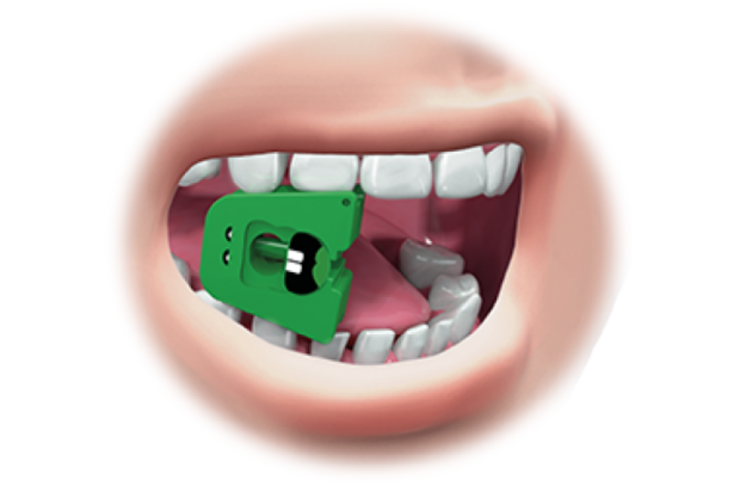 Angelus Mouth Rest - Ref. 404 (image 1 of 2)