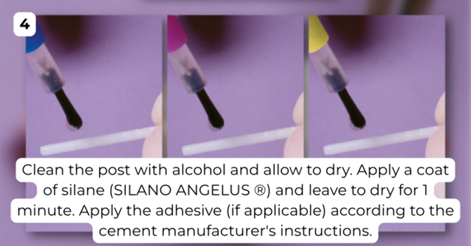 Angelus Reforpost Glass Fiber - Ref. 726 (image 6 of 10)